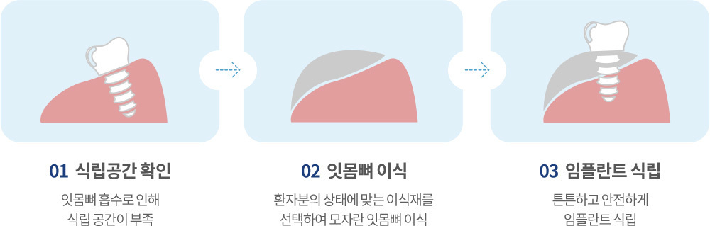 시술과정